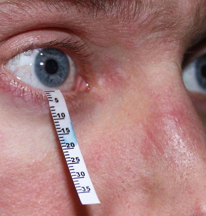 What's the name of this test in Sjorgen disease? !!