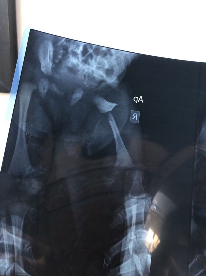 X-ray of a 8 days old baby