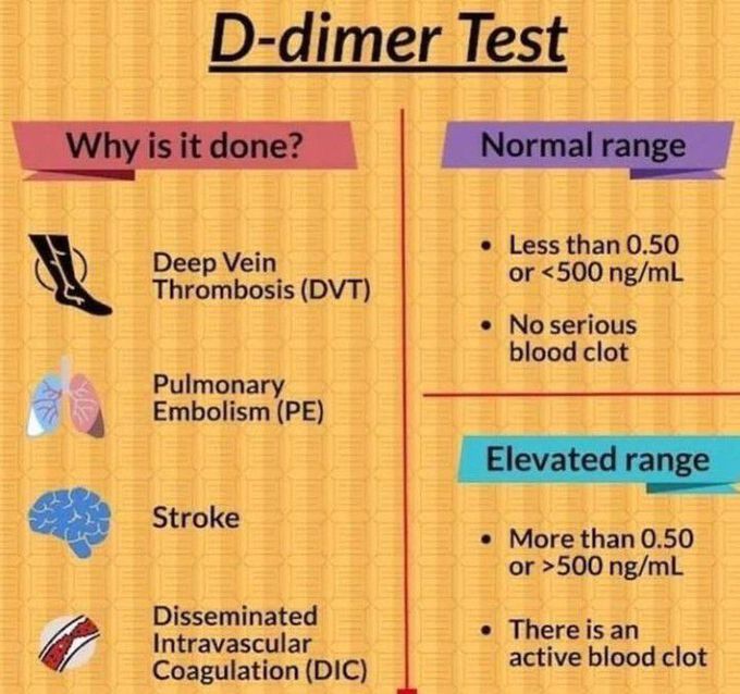 Important information about D-Dimer test