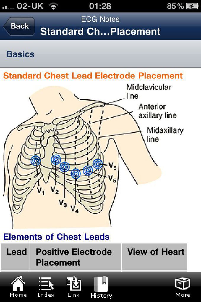 ECG chart