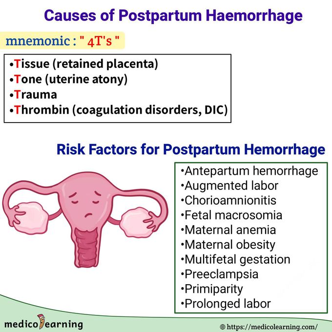 causes-of-postpartum-haemorrhage-medizzy