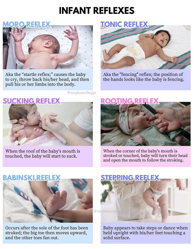 Infant Reflexes II