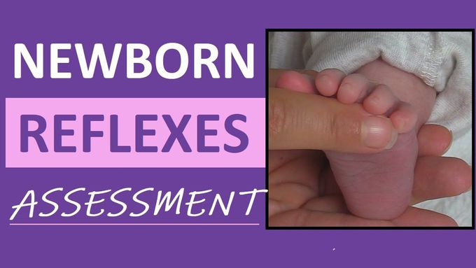 Newborn Reflexes Assessment (Infant)