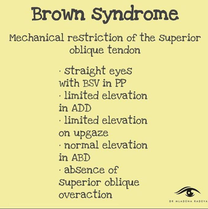 Brown syndrome