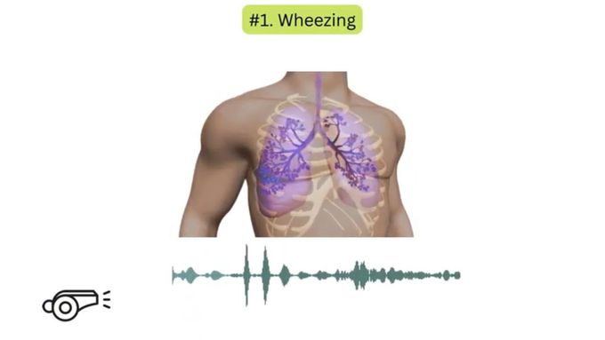 Abnormal lung sounds in COPD