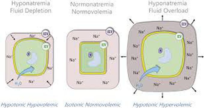 Treatment for hyponatremia