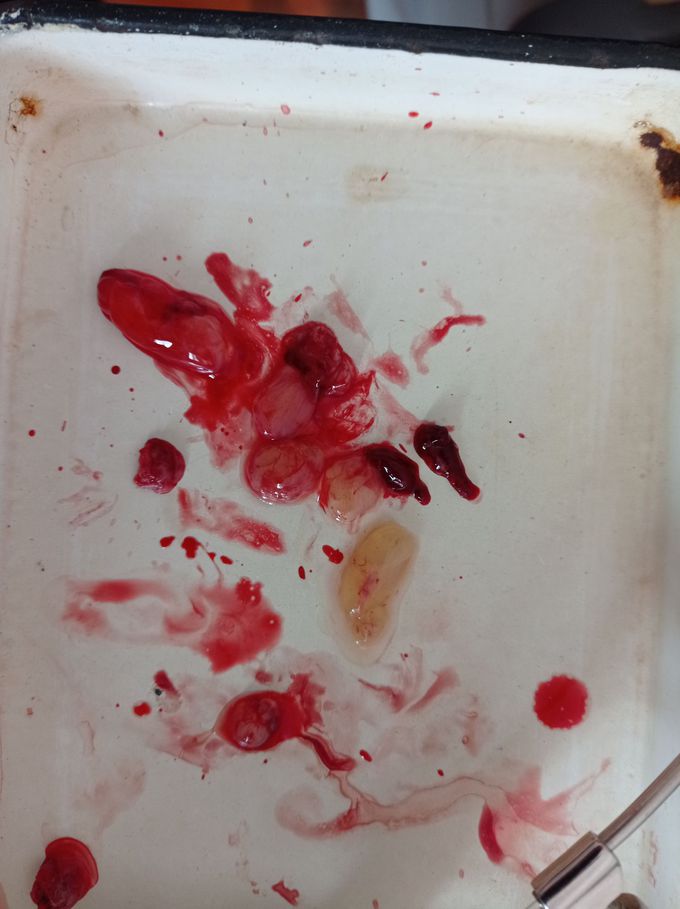 Many polyps
