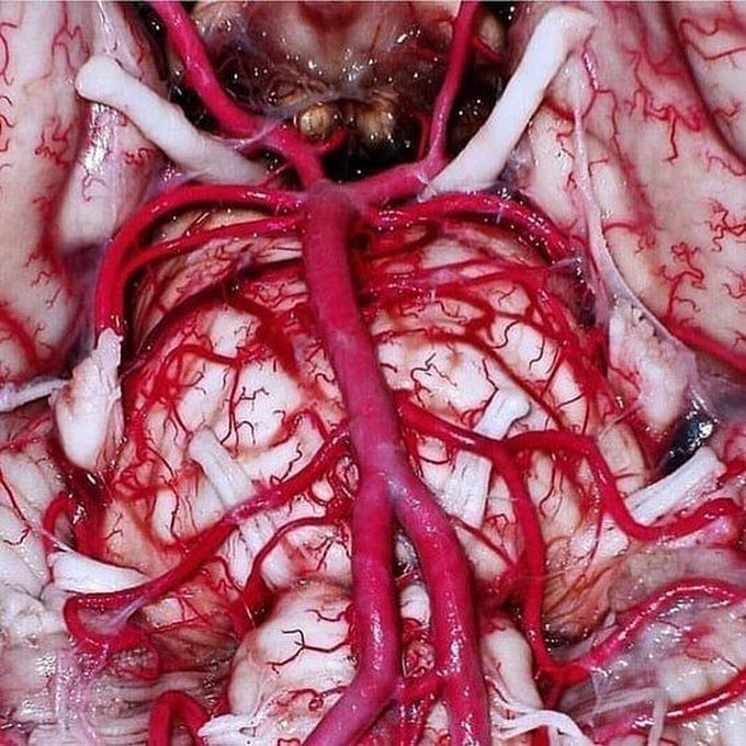 The Circle of Willis