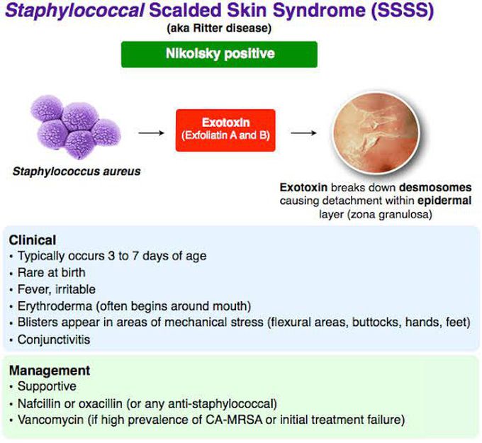 Staphylococcal Scalded Skin Syndrome