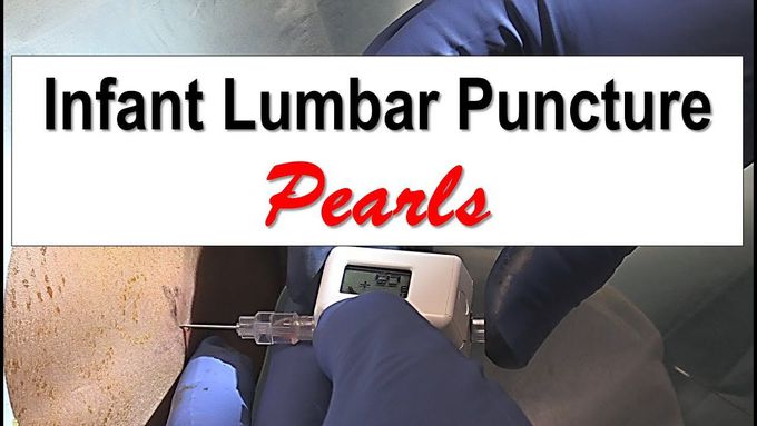 Infant Lumbar Puncture Pearls