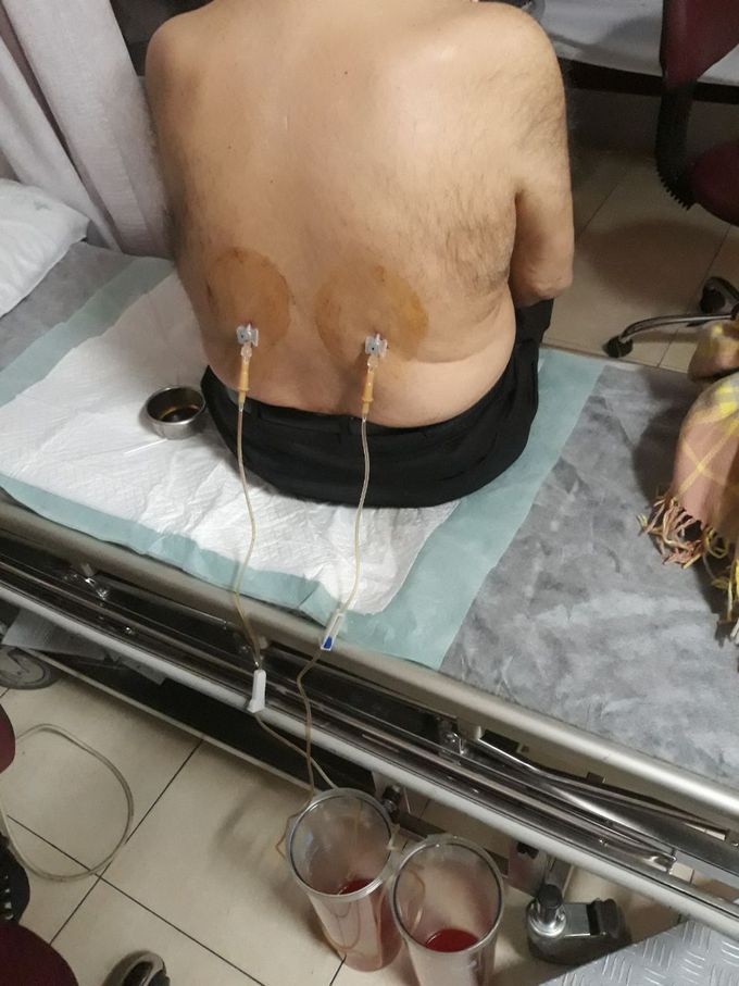 Diagnosis?