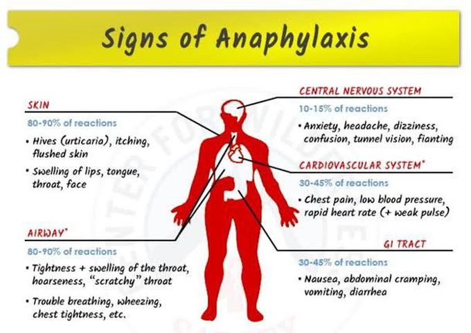 Anaphylaxis