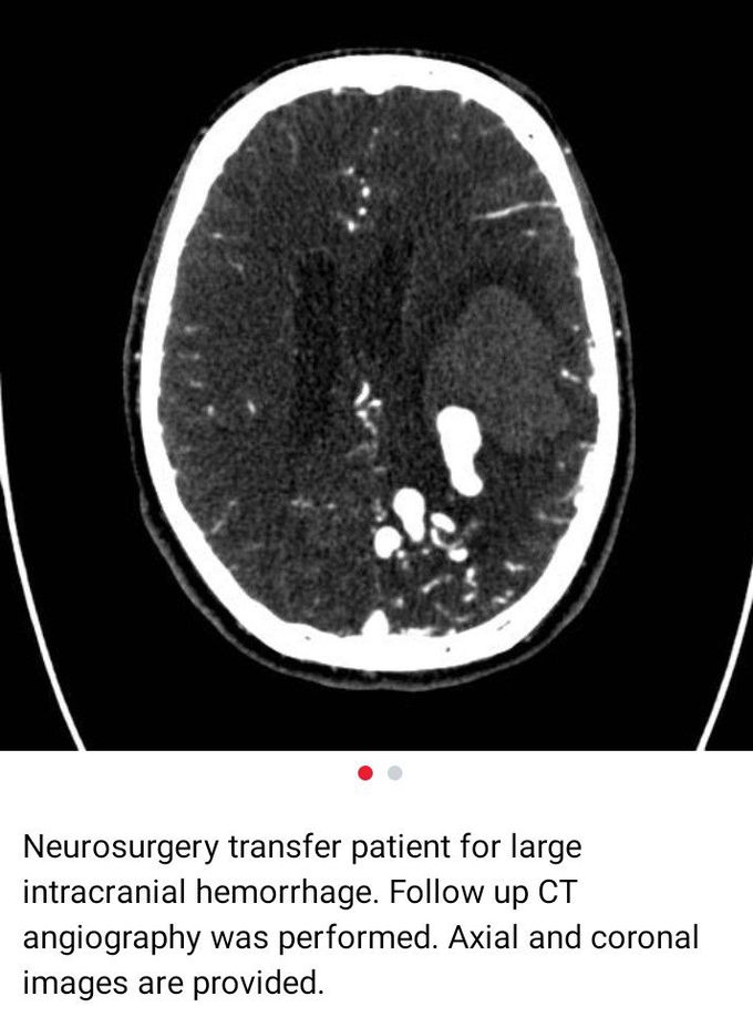 Neurosurgery