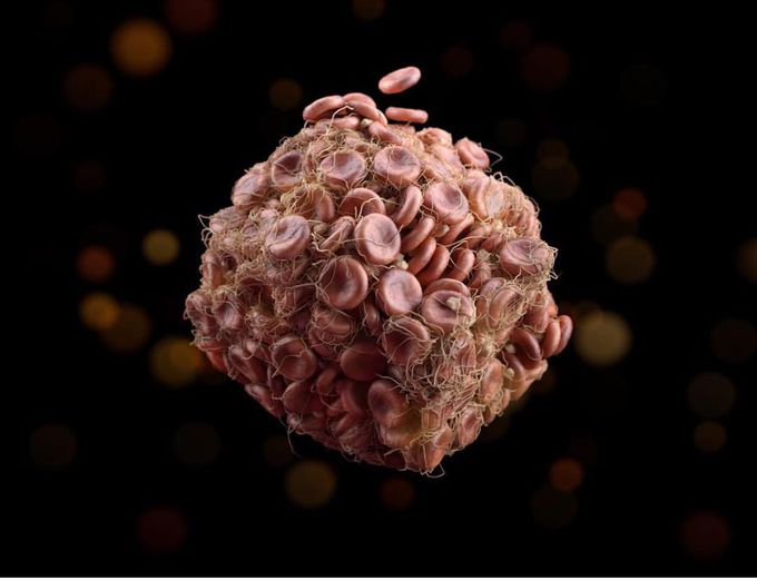 Blood clots