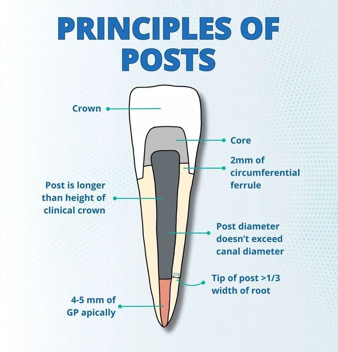 The Post