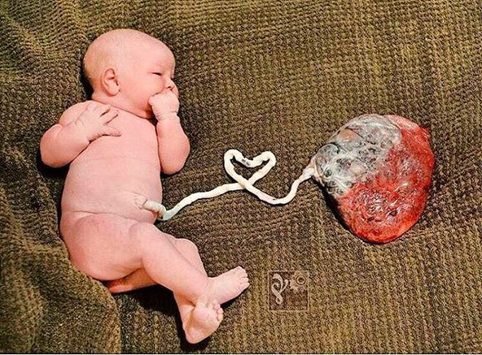 New Born with Placenta intact
