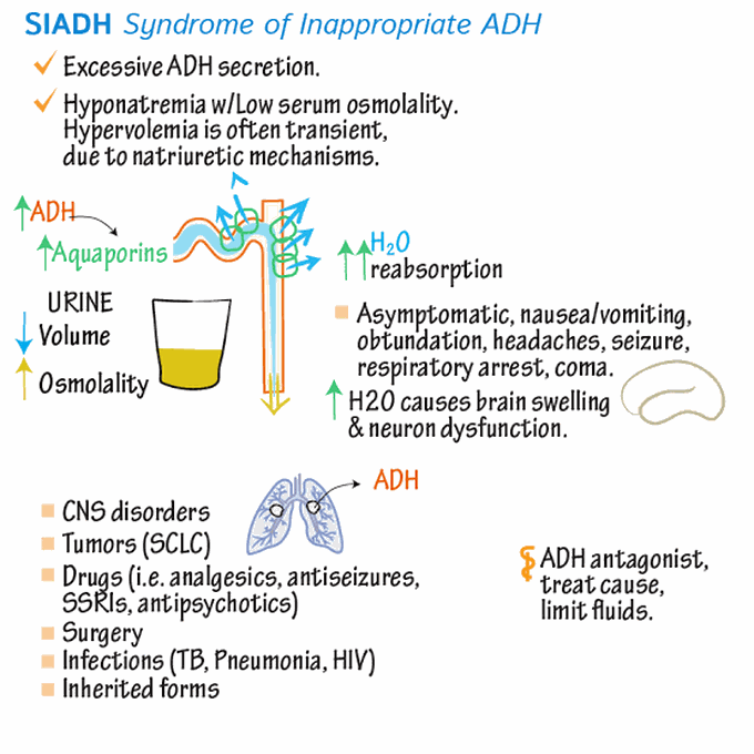 Syndrome of inappropriate antidiuretic hormone medizzy