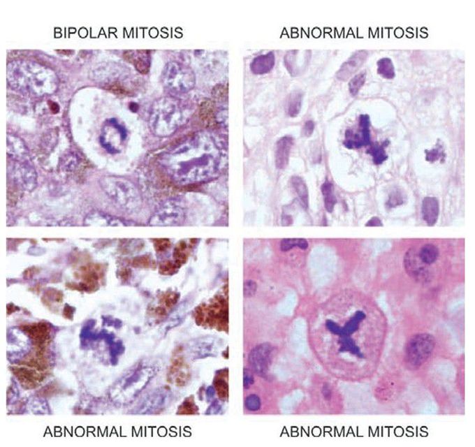 mitotic figures.