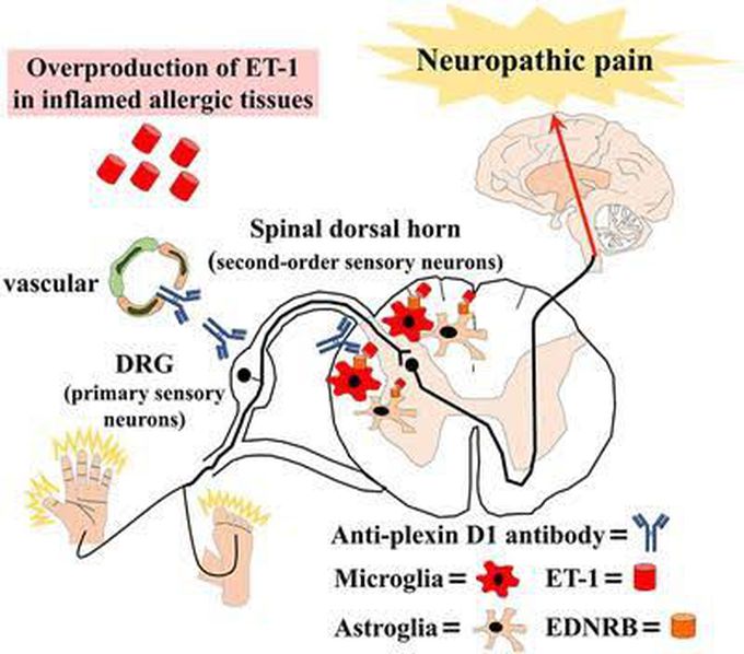 gabapentin mode action neuropathic pain