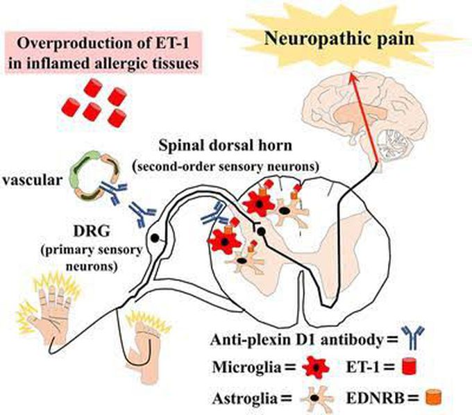 Neuropathic pain