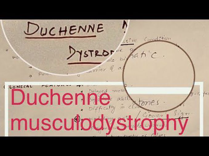 Duchenne Muscular Dystrophy.