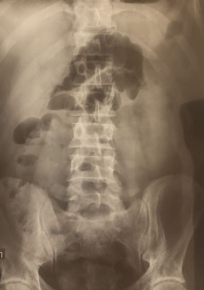 What is your diagnosis?