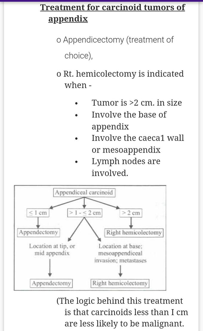 Treatment of Carcinoid tumor of Appendix