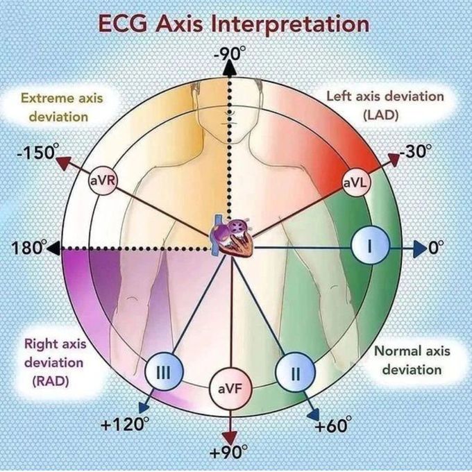 ECG Axis Interpretation