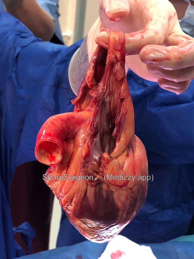 Human heart ❤️