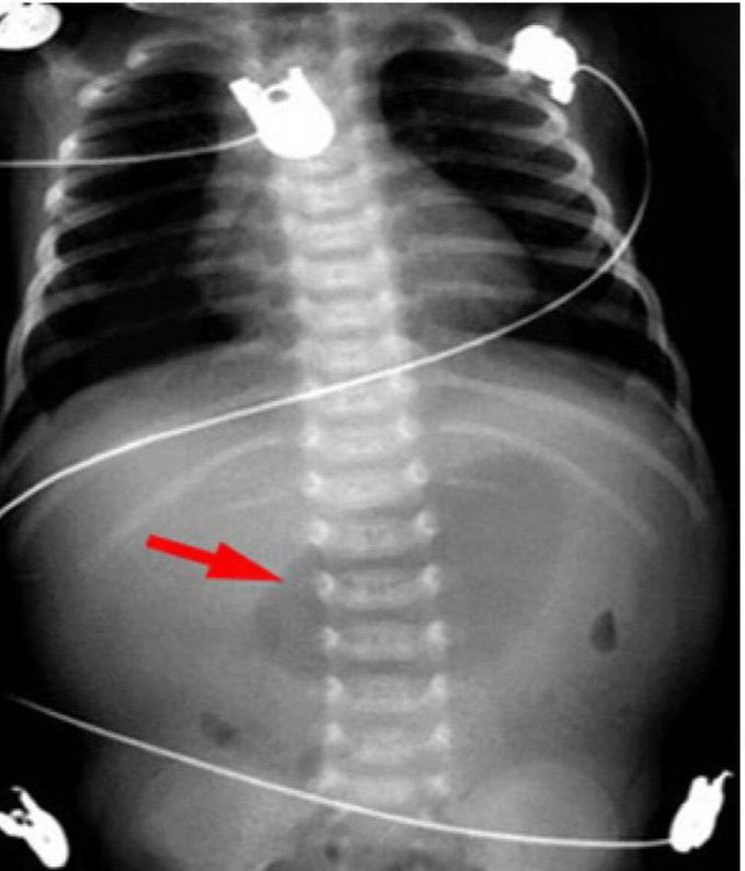 Identify the Appearance