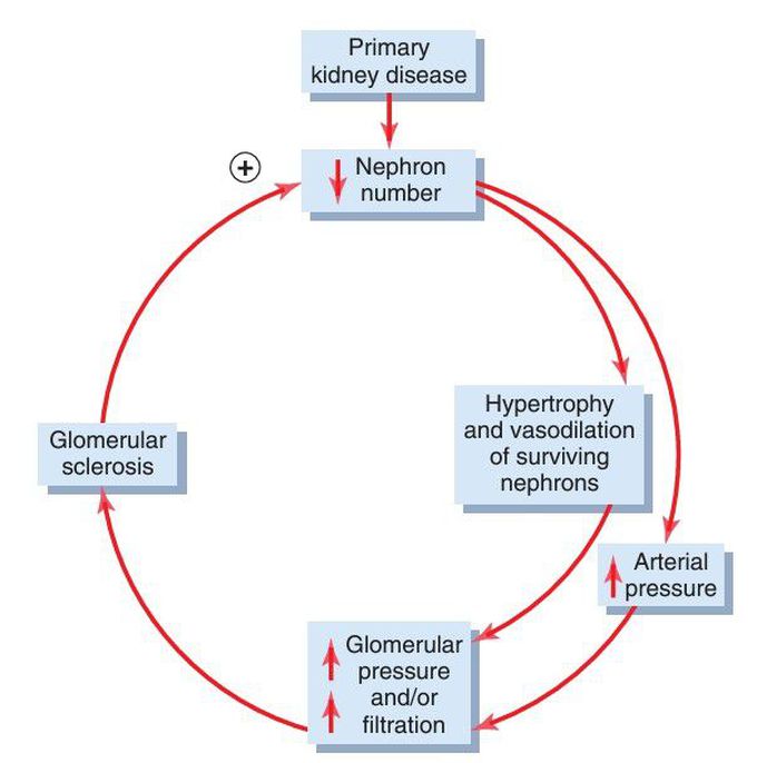 Primary kidney disease