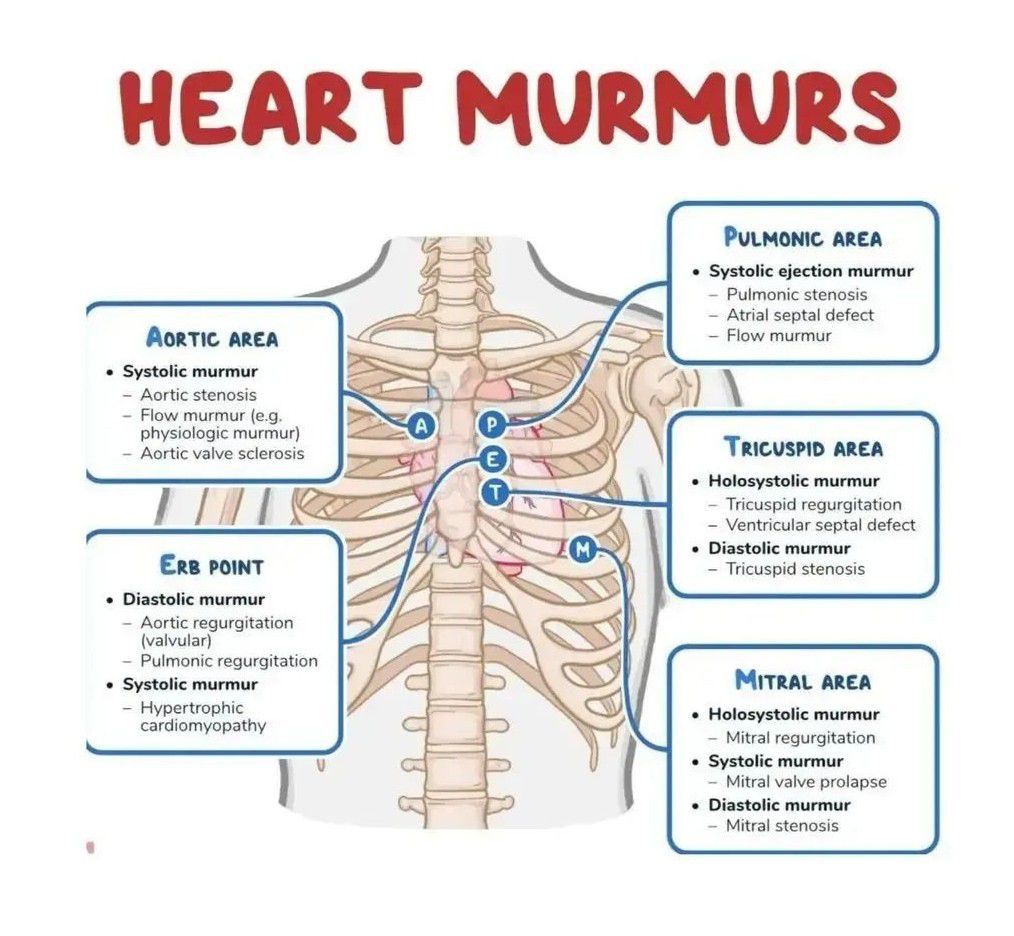 What Does A Loud Heart Murmur Indicate