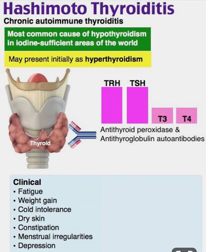 Thyroid