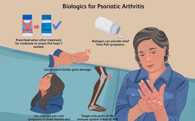Treatment for Psoriatic arthritis