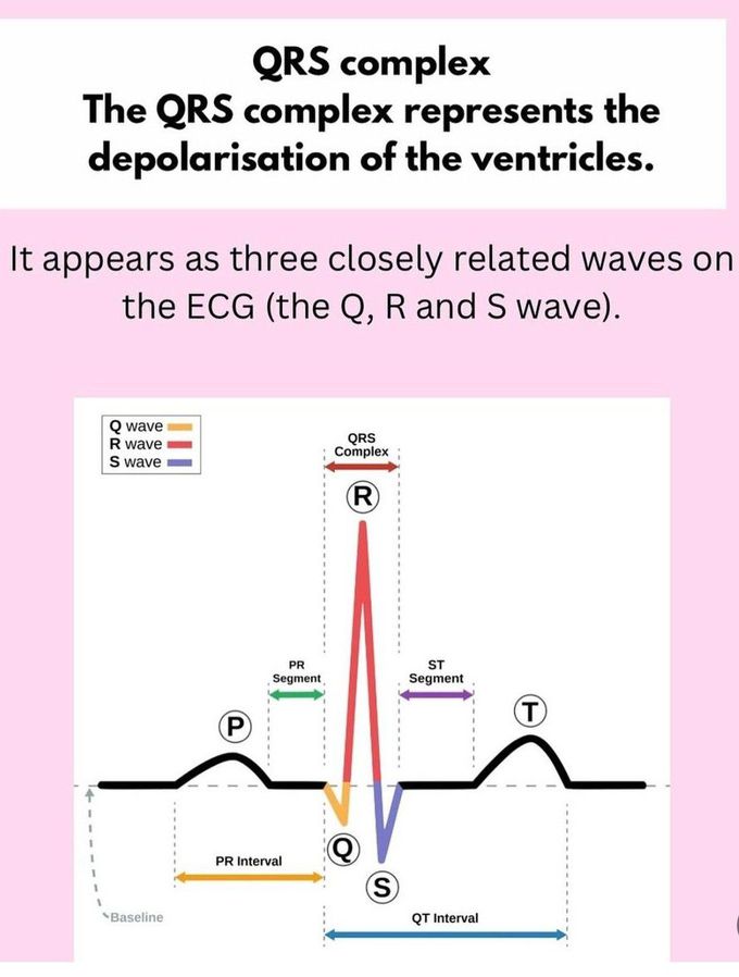 ECG Basics III - MEDizzy