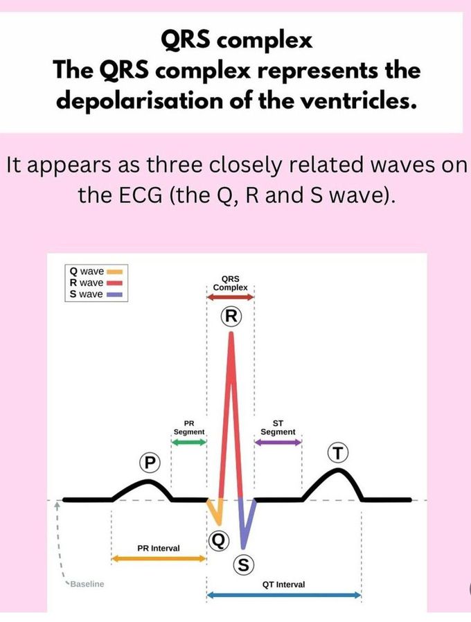 ECG Basics III