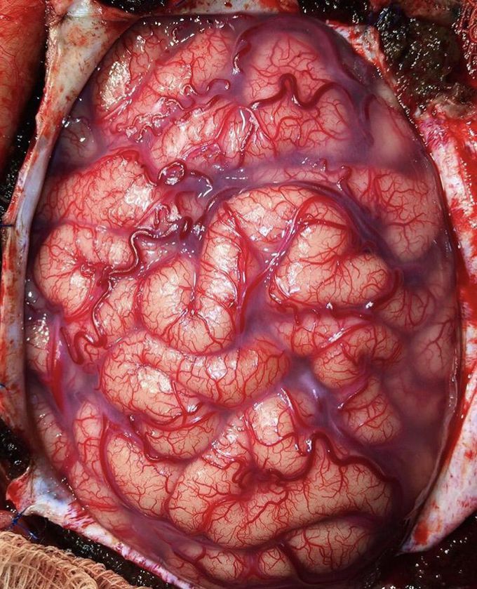 Brain