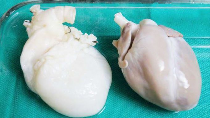 10 Unbelievable Recent Medical Discoveries