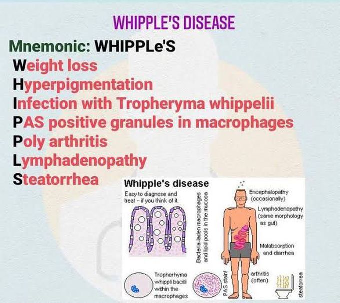 whipples disease symptoms