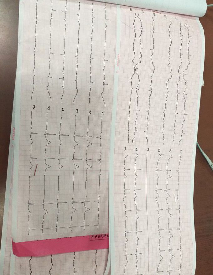 What is your diagnosis?