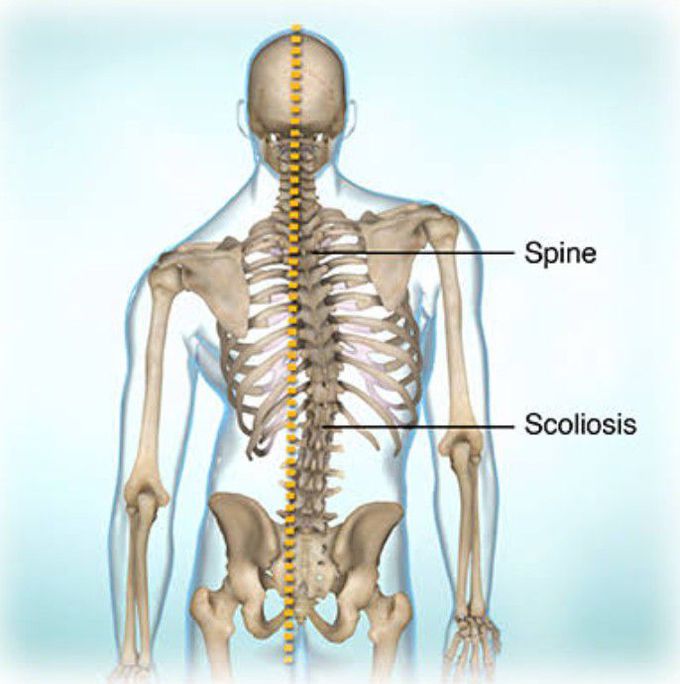 Friedreich's ataxia