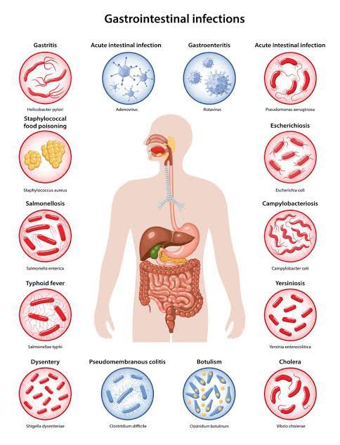 Gastroenteritis Pain That Comes And Goes