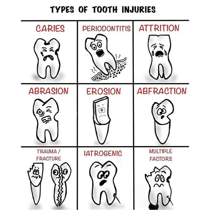 Type of tooth injuries