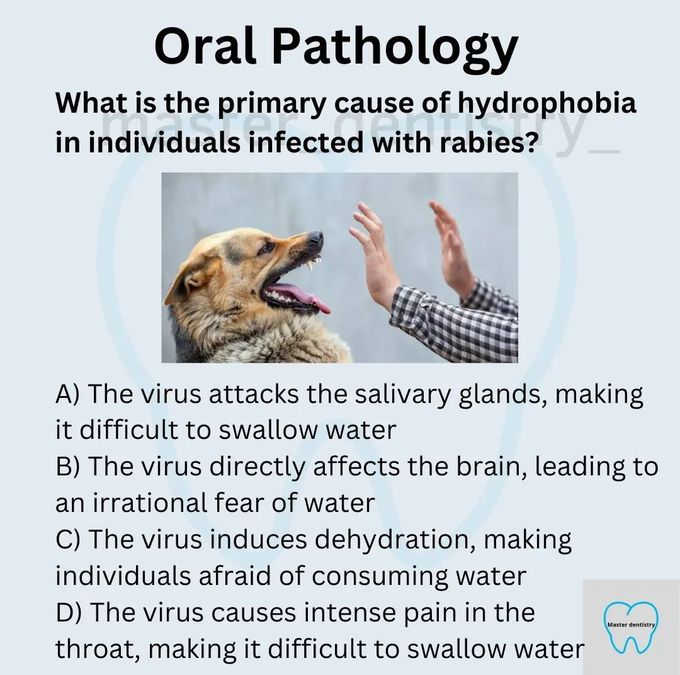 Hydrophobia In Rabies