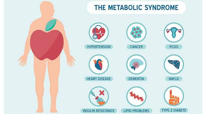 Metabollic Syndrome