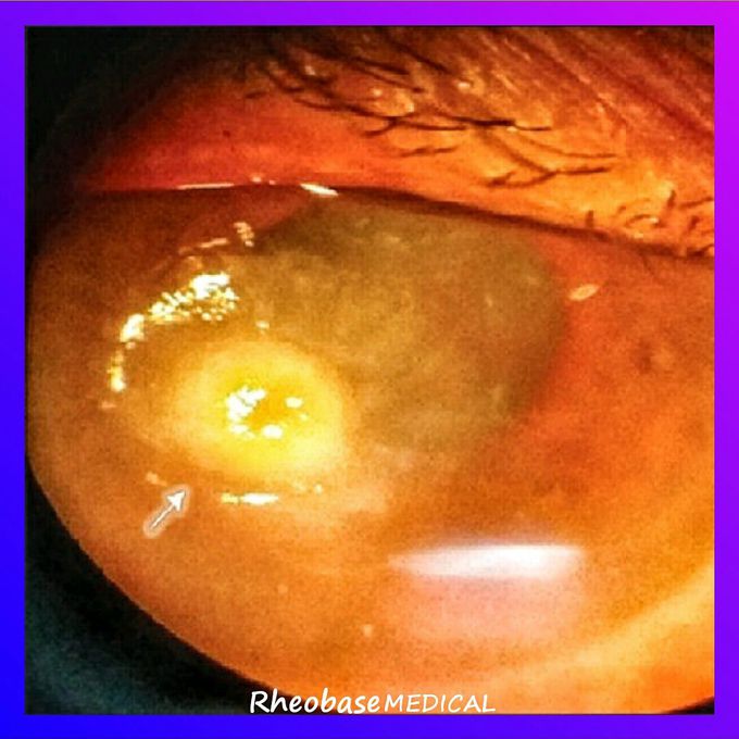 Clinical case