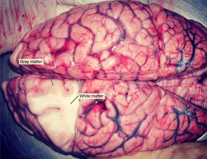 Grey & White matter!