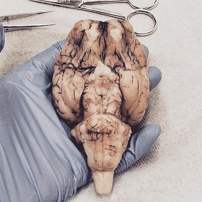 Amazing picture showing the brainstem