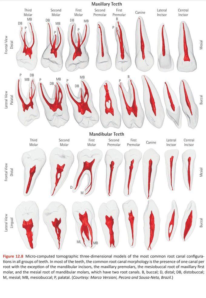 Root canal configuration