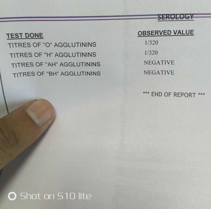 Patient come with high fever..!  Diagnosis?????